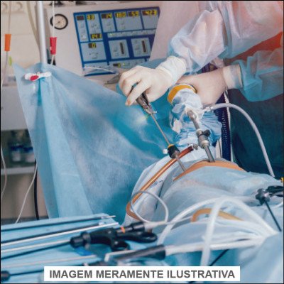 Cirurgia Ginecológica