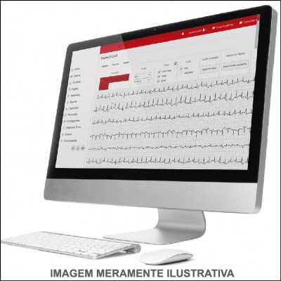 Eletrocardiograma de Alta Resolução
