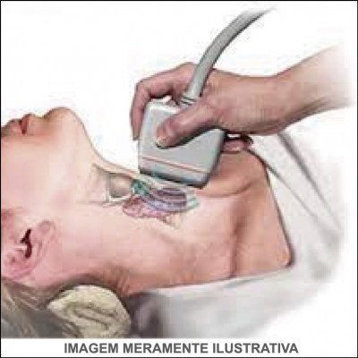 Doppler de Carótidas e Vertebrais