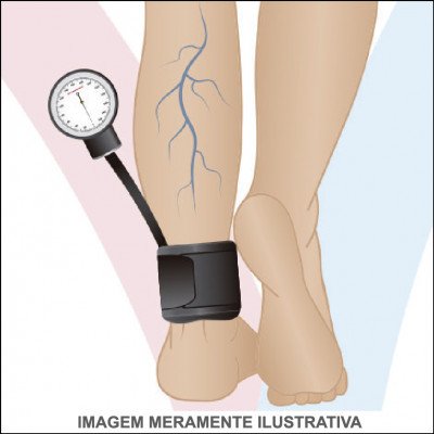 Holter de 24h | ITB - Índice de Tornozelo-Branquial
