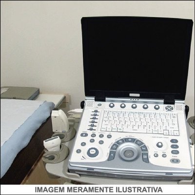 Ecocardiograma Transtorácico