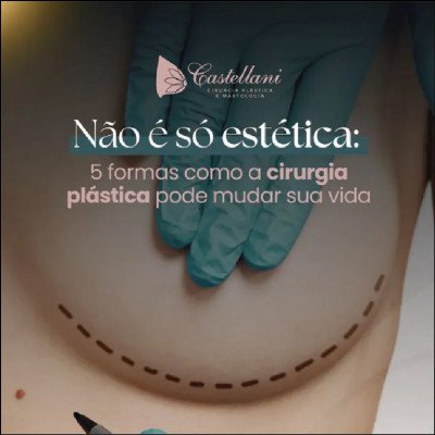 Cirurgias Plásticas
