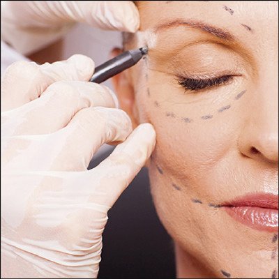 Rejuvenescimento Facial (PRP)