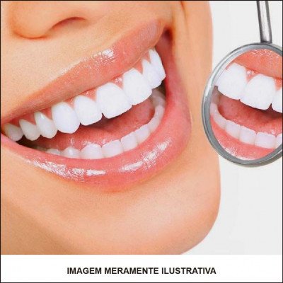 Tratamento Estético Dental