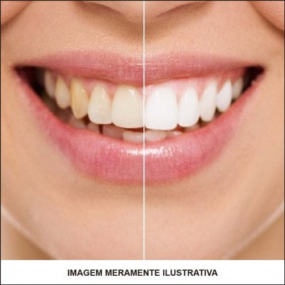 Clareamento Dental