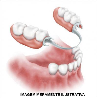 Próteses Dentárias