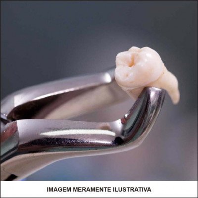 Extração de Dentes