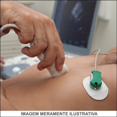 Ecocardiograma Transtorácico