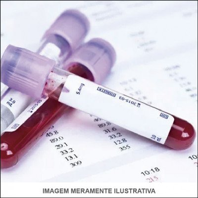 Exame de Sangue