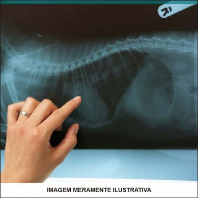 Raio-X Digital